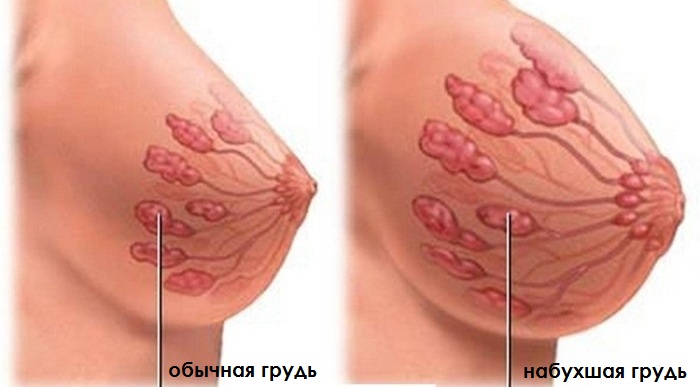 Ореолы потемнели не беременна 9